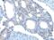 Unc-5 Netrin Receptor B antibody, PA5-67631, Invitrogen Antibodies, Immunohistochemistry frozen image 