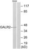 Galanin Receptor 2 antibody, LS-C120667, Lifespan Biosciences, Western Blot image 
