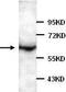 Adrenoceptor Alpha 1B antibody, TA310099, Origene, Western Blot image 