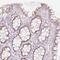 DNA Damage Regulated Autophagy Modulator 2 antibody, HPA061701, Atlas Antibodies, Immunohistochemistry frozen image 