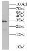 Sulfotransferase Family 1C Member 2 antibody, FNab08381, FineTest, Western Blot image 
