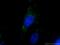 Early Endosome Antigen 1 antibody, 66218-1-Ig, Proteintech Group, Immunofluorescence image 