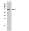 Adhesion G Protein-Coupled Receptor G5 antibody, A12882, Boster Biological Technology, Western Blot image 