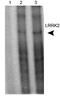 Leucine Rich Repeat Kinase 2 antibody, NB300-268, Novus Biologicals, Immunoprecipitation image 