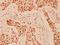 Histone Deacetylase 9 antibody, A02177, Boster Biological Technology, Immunohistochemistry frozen image 