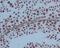 Poly(ADP-Ribose) Polymerase 1 antibody, M00122, Boster Biological Technology, Immunohistochemistry paraffin image 