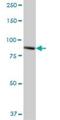 Tetratricopeptide repeat protein 7B antibody, H00145567-B01P, Novus Biologicals, Western Blot image 