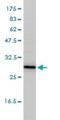 Thiopurine S-Methyltransferase antibody, H00007172-M01, Novus Biologicals, Western Blot image 