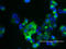 Mucin 1, Cell Surface Associated antibody, LS-C175472, Lifespan Biosciences, Immunofluorescence image 