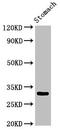 Glutamate-Cysteine Ligase Modifier Subunit antibody, CSB-PA009322LA01HU, Cusabio, Western Blot image 