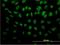 Polypyrimidine Tract Binding Protein 3 antibody, H00009991-M01, Novus Biologicals, Immunofluorescence image 