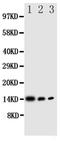 IL-4 antibody, PA1749, Boster Biological Technology, Western Blot image 