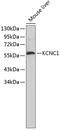 Potassium voltage-gated channel subfamily C member 1 antibody, 18-899, ProSci, Western Blot image 