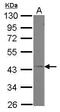 G Protein Subunit Alpha 11 antibody, PA5-31289, Invitrogen Antibodies, Western Blot image 
