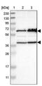 Chloride Channel CLIC Like 1 antibody, PA5-53036, Invitrogen Antibodies, Western Blot image 