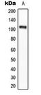 Eukaryotic Elongation Factor 2 Kinase antibody, GTX32365, GeneTex, Western Blot image 