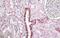 Transforming Growth Factor Beta Induced antibody, NBP1-47215, Novus Biologicals, Immunohistochemistry paraffin image 