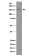 Bromodomain Containing 4 antibody, M00123, Boster Biological Technology, Western Blot image 