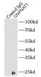 Glucosamine-Phosphate N-Acetyltransferase 1 antibody, FNab03554, FineTest, Immunoprecipitation image 