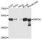 Glycogen Synthase Kinase 3 Alpha antibody, MBS125885, MyBioSource, Western Blot image 