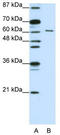 CUGBP Elav-Like Family Member 2 antibody, TA345750, Origene, Western Blot image 