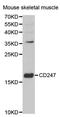 CD247 Molecule antibody, STJ22982, St John