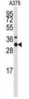 Syntaxin 3 antibody, GTX82488, GeneTex, Western Blot image 