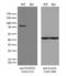 Hydroxyacyl-CoA Dehydrogenase Trifunctional Multienzyme Complex Subunit Alpha antibody, LS-C796270, Lifespan Biosciences, Western Blot image 