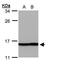 Profilin 2 antibody, PA5-21959, Invitrogen Antibodies, Western Blot image 