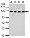 Damage Specific DNA Binding Protein 1 antibody, GTX100232, GeneTex, Western Blot image 