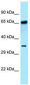 Fucose-1-Phosphate Guanylyltransferase antibody, TA343244, Origene, Western Blot image 