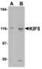 Kinesin Family Member 5A antibody, A03635, Boster Biological Technology, Western Blot image 