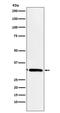 Microtubule Associated Protein RP/EB Family Member 3 antibody, M05782-1, Boster Biological Technology, Western Blot image 
