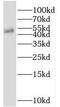 Proteasome 26S Subunit, Non-ATPase 11 antibody, FNab06883, FineTest, Western Blot image 