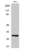 NAD(P)HX Epimerase antibody, STJ91512, St John