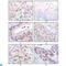 Lysine Acetyltransferase 8 antibody, LS-C812706, Lifespan Biosciences, Immunohistochemistry paraffin image 