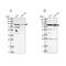 Spermatogenesis Associated 20 antibody, PA5-55523, Invitrogen Antibodies, Western Blot image 