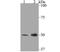 Potassium Two Pore Domain Channel Subfamily K Member 4 antibody, NBP2-76938, Novus Biologicals, Western Blot image 