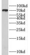 Radial Spoke Head 3 antibody, FNab07509, FineTest, Western Blot image 