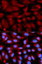 CD70 Molecule antibody, STJ23009, St John