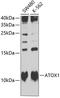 Antioxidant 1 Copper Chaperone antibody, A6874, ABclonal Technology, Western Blot image 