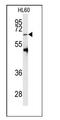 Protein arginine N-methyltransferase 5 antibody, AP11010PU-N, Origene, Western Blot image 