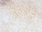CD59 Molecule (CD59 Blood Group) antibody, NBP2-48466, Novus Biologicals, Immunohistochemistry paraffin image 