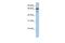 Selenoprotein N antibody, A03658, Boster Biological Technology, Western Blot image 