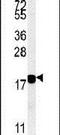 Synuclein Beta antibody, PA5-25738, Invitrogen Antibodies, Western Blot image 