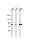 Phospholipase A2 Group IVD antibody, PA5-72287, Invitrogen Antibodies, Western Blot image 