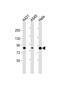 Phospholipase A2 Group IVD antibody, PA5-72287, Invitrogen Antibodies, Western Blot image 