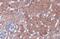 NAD(P)H Quinone Dehydrogenase 1 antibody, NBP1-31355, Novus Biologicals, Immunohistochemistry paraffin image 