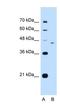 FIC Domain Containing antibody, NBP1-58294, Novus Biologicals, Western Blot image 