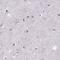 Interphotoreceptor Matrix Proteoglycan 1 antibody, PA5-65006, Invitrogen Antibodies, Immunohistochemistry frozen image 